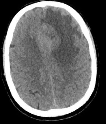 fig 1 1