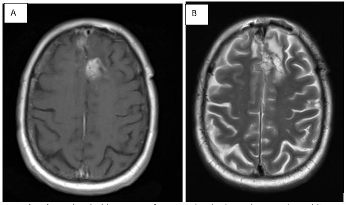 fig 12