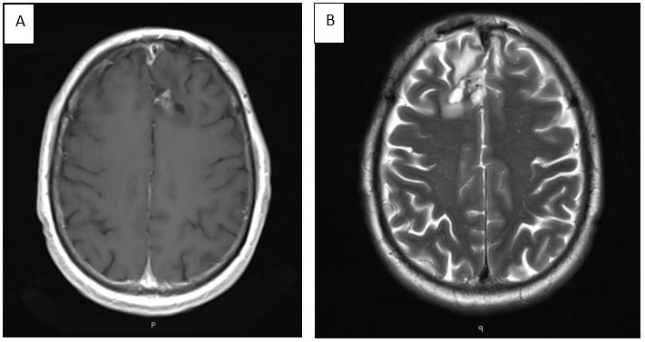fig 13