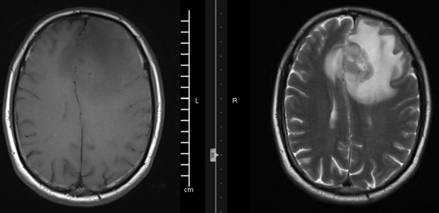 fig 2 1