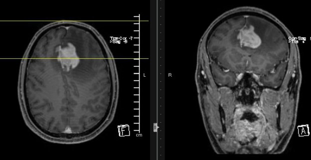 fig 3 1