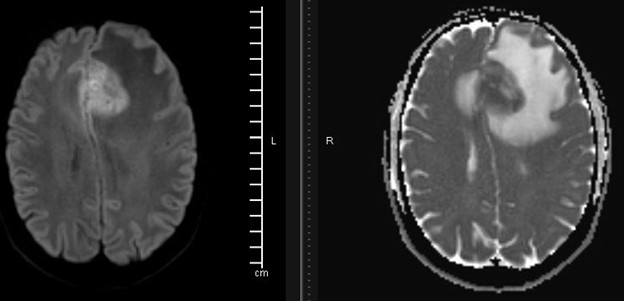 fig 4 1
