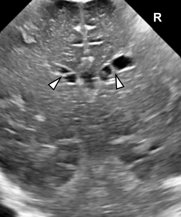 Fig 3a CR 1p36 ed Fig 3a CR 1p36 ed