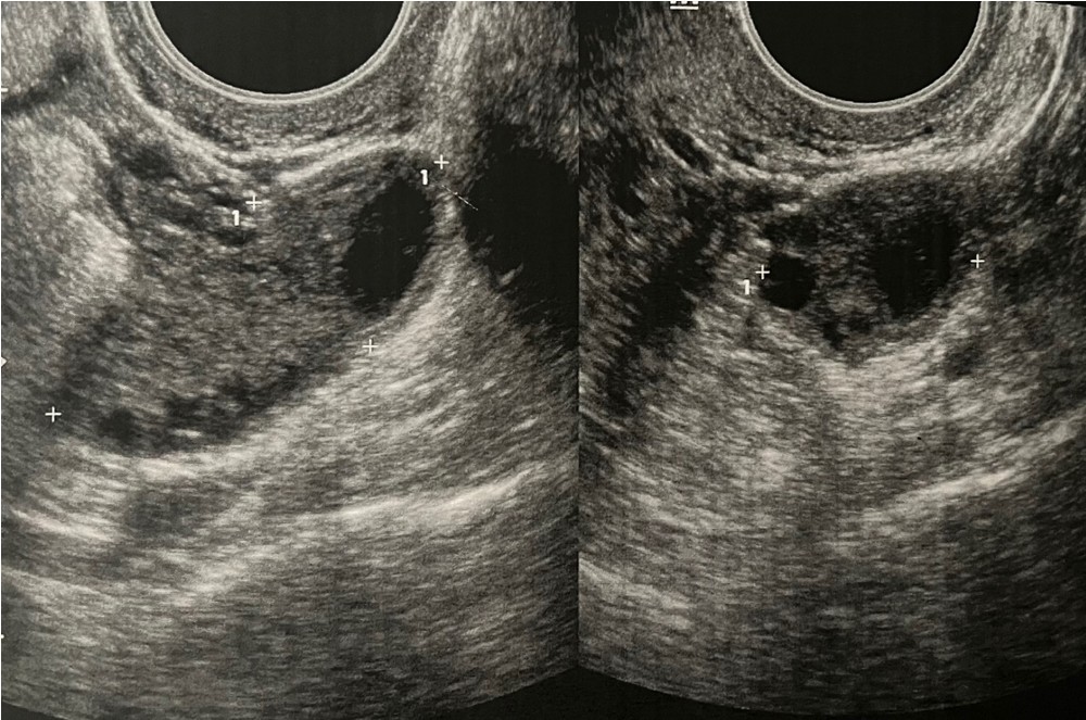 fig 1a fig 1a